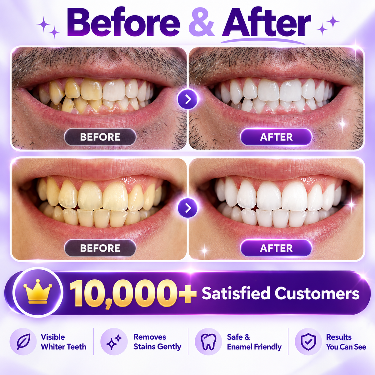 Pack of 7 Violet Teeth Whitening Strips | Brighter Smile in 30 Minutes
